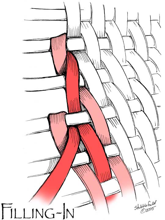 [Filling-In Diagram]